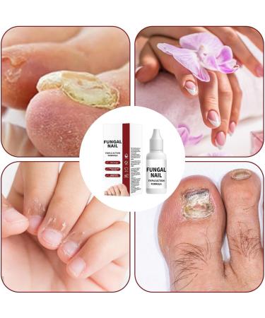 Nail Repair Liquid | Repairing Solution for Damaged Hands and Feet | 15 ml Deep Moisturizer for All Seasons | For Dorms Camping Living Room Home Travel Gym - Buy Online on GoSupps.com