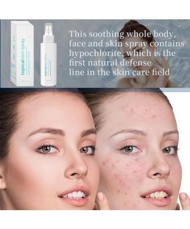 Moisturizing Face Spray | Soothing Redness 120ml - Moisturizing Spray | For Dry Skin Men Women and Teenagers - Buy Online on GoSupps.com