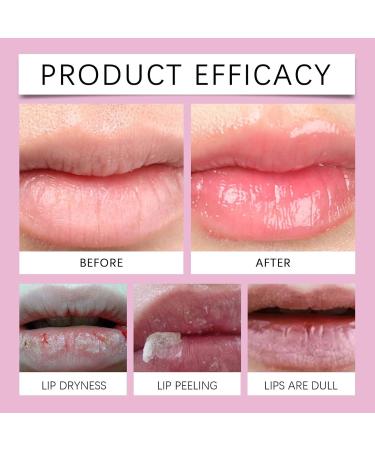 Repairing Treatment for Dry Lips Intensive Moisturizing Oil for Chapped and Damaged Lips Daily Night Care 30ml Balm for Men and Women with Sensitive Skin Soothing - Buy Online on GoSupps.com