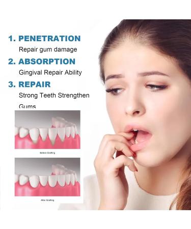 Buy Gum Regrowth Drops | Effective Gums Repair & Growth Solutions - Dentizous Gums Junior Drops - Buy Online on GoSupps.com