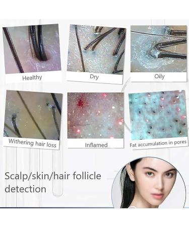 Skin Diagnosis Hair Analyzer - 5 in 1 WiFi 5G 1000w Pixels 50x/200x Lens for Home Beauty & Hair Care - Buy Online on GoSupps.com