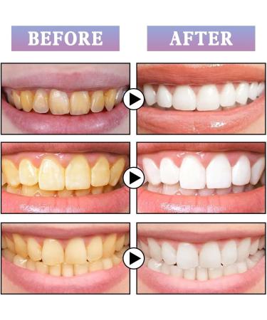 Tooth Gloss Whitening Pen - Instant Results Stain Removal & Gloss (2PCs) - Shop Internationally! - Buy Online on GoSupps.com