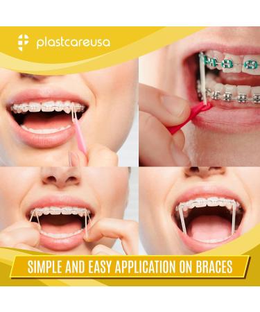 1000 Orthodontic Latex Elastic Rubber Bands for Braces - Heavy-Duty 1/4 Fox Multi-Size Dental Elastics Kit for Teeth Alignment & Gap Closure (10 Bags of 100 - Buy Online on GoSupps.com