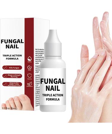 Whrcy Fingernail repair drops Damaged Hands Feet Nails Repair Solution 15ml Deep Hydration Booster with Precise Dropper for All Seasons Teens Adults Women - Buy Online on GoSupps.com