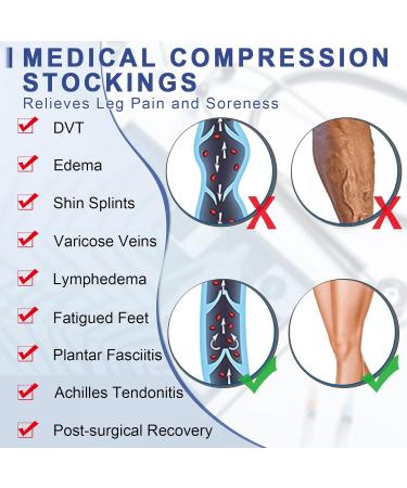 Medical Compression Stockings for Men & Women | Thigh Support 20-30 mmHg for Varicose Veins & Edema Beer Beige Klein - Buy Online on GoSupps.com