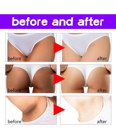 Brightening Intimate Parties Whitening Cream for Intimate Parts Intimate Cream Woman Irritation Brightening Armpit Cream Bleaching Cream for Private Parts (1) - Buy Online on GoSupps.com