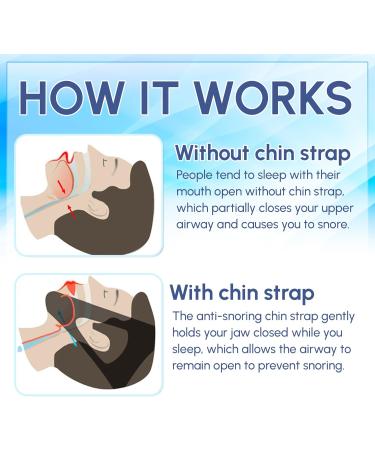 Adjustable Anti Snore Chin Strap - Effective Snoring Solution for Sleep Apnea - Breathable CPAP Alternative - Unisex Aid - Buy Online on GoSupps.com