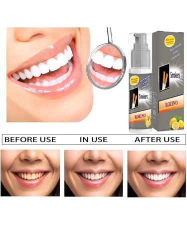 Lemon Toothpaste for Whiter Teeth | 30ml Foaming Lemon Teeth Whitening & Cleaning | Geruwam - Buy Online on GoSupps.com