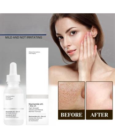 10% Niacinamide Serum+ 1% Zinc Serum Niacinamide Face Serum Niacinamide and Zinc Face Moisturiser Anti Aging & Wrinkle Face Serum Tackles Blemishes Minimises Pore Face Serum for Women Skincare Serum - Buy Online on GoSupps.com