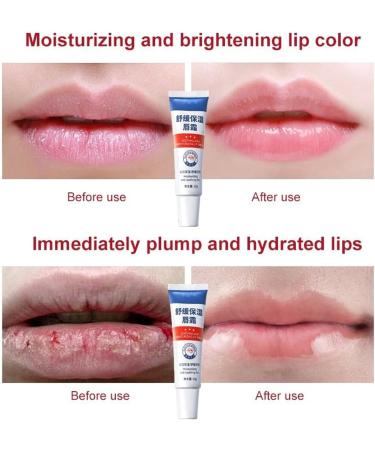 GeRRiT Lip Lightening Balm for Dark Lips Whitening Essence Lip Balm for Lips Long Lasting Brightening Exfoliating Balm to Remove Dull Lips - Buy Online on GoSupps.com