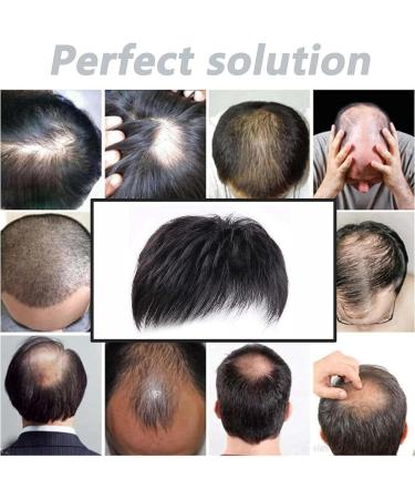 Hair System Men | Men's Toupee | Hair Replacement Patch Men Men's Toupee V-Shape Hairline Hair Extension Real Human Hair Invisible Forehead Hairpiece Natural Hairpiece for Men - Buy Online on GoSupps.com