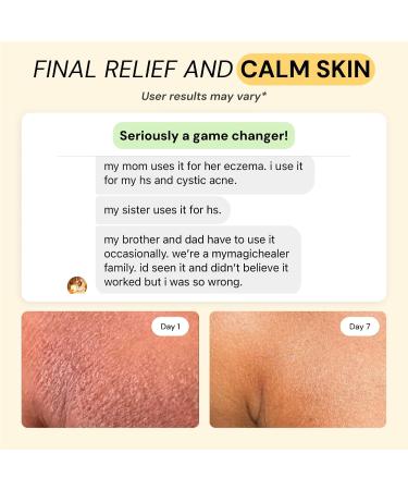 MyMagicHealer Complete Flare Care | Universal Flare & Universal Essential Oil Free Flare Care | Dual Relief for HS, Boils & Cysts, Eczema, Diaper Rash, Psoriasis, Impetigo | Drawing Salve (2 x 1oz) - Buy Online on GoSupps.com