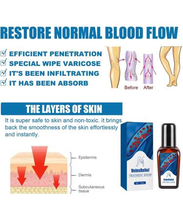 Ambayz Vein Relief Treatment for Varicose Veins - Improve Blood Circulation | 1 Piece - Buy Online on GoSupps.com