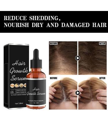 Rennora Hair Growth Serum - Organic Hair Growth Oil for Black Women Fast Results for Thinning & Hair Loss - Buy Online on GoSupps.com