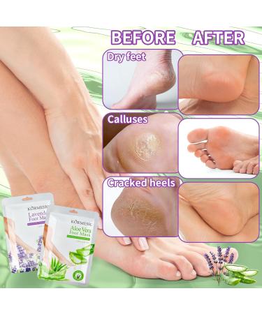 Lot de 8 masques pour les pieds Chaussettes pour les pieds Masque hydratant pour les pieds - Adoucit les talons secs et d chir s les pieds rugueux et am liore les callosit s (4 x lavande et 4 x - Buy Online on GoSupps.com