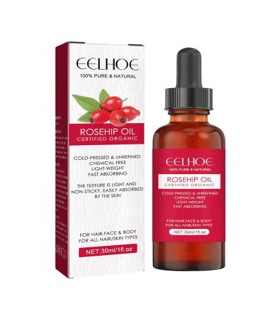 Royal Oil - Pure Natural Rose Hip Kernel Oil 30ml | Moisturizing Skin Care for All Skin Types | Essential Oil for Face Hair & Nails - Buy Online on GoSupps.com