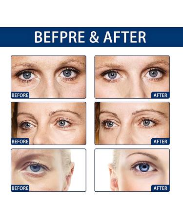 Eye Cream for Dark Circles and Puffy Eyes Eye Cream Anti Aging Anti Wrinkle Eye Cream Under Eye Cream Reduce Fine Lines with Collagen Aloe Extract - Buy Online on GoSupps.com