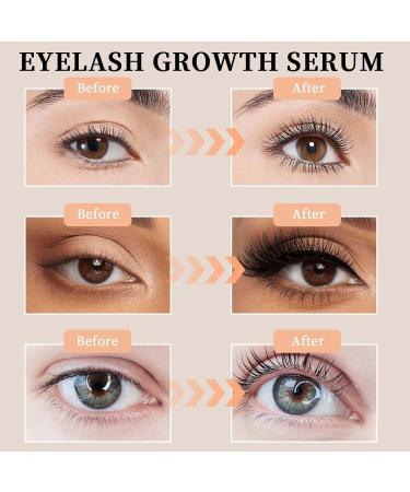 Lash Serum - Eyelash Growth & Thickness Enhancer | Advanced Formula for Natural Lashes | 0.1 Fl. Oz | International Shipping Available - Buy Online on GoSupps.com