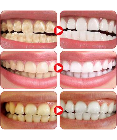 Sp-6 Fresh Breath Toothpaste Sp-6 Probiotic Toothpaste Sp-6 Toothpaste Probiotic Toothpaste Fresh Breath Toothpaste Removes Stains Complete Dental Care - Buy Online on GoSupps.com