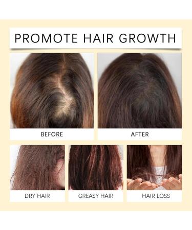 zwxqe Strengthening hair oil natural hair massage oil hair smoothing oil long lasting hair shine straight and curly hair care vegetable oil for hair hair oil for hair hair oil for - Buy Online on GoSupps.com