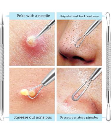LitBear Pore Prep Tool | Blackhead Remover & Pimple Popper Kit | Stainless Steel Extraction Tool for Acne, Whitehead, Blemish & Comedone - Buy Online on GoSupps.com