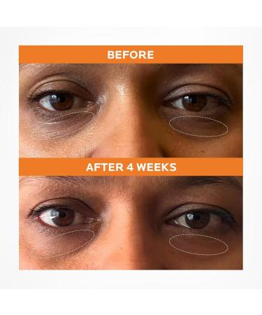 Dr. Pure Caffeine Solution 5% EGCG Eye Contour Serum - Reduce Puffiness & Dark Circles | Hydrating Formula with Hyaluronic Acid - 2 Fl Oz - Buy Online on GoSupps.com