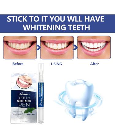 Teeth Whitening Pen 4-Pack Teeth Whitening Gel Kit Natural Formula Removes Years of Stains Enamel Whitening Gel Fast and Gentle Whitening Teeth - Buy Online on GoSupps.com