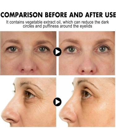 SEAGRIL Anti-Wrinkle Serum & Collagen Boost Cream | Instant Eye Lift - 3PC Anti-Aging Set - Buy Online on GoSupps.com