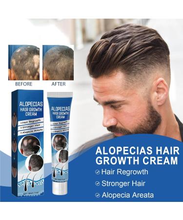Alopecia Cr me de croissance des cheveux p te capillaire naturelle cr me paississante des cheveux formule naturelle pratique compacte 20 g pour homme et femme adulte - Buy Online on GoSupps.com