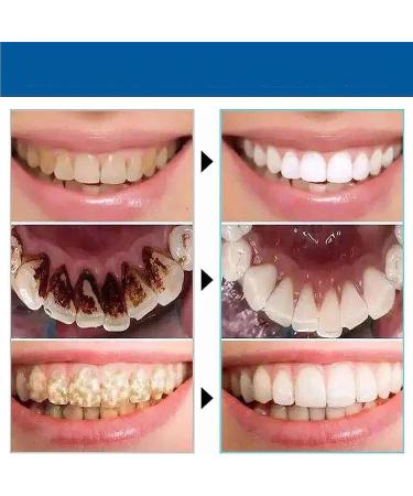 Prediotics Whitening Toothpaste with Probiotics - SP-Y6 for Healthy Teeth & Gums (1pc) - Best International Shipping - Buy Online on GoSupps.com