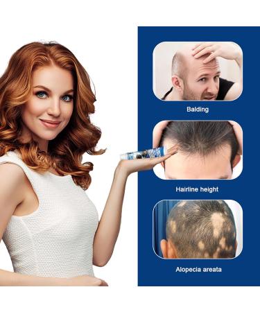  G n rique Baldness Cream - 20g Hair Growth Oil for Fast-Acting Effective Use Anti-Alopecia with High Hairline Solution Hairless Baldhead Hair Development Moisturizer for Men Women Thinning - Buy Online on GoSupps.com