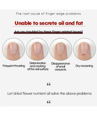 MKNZOME Nail Oil Cuticle 3PCS Nail Oil Treatment Moisturizing and Nourishing Cuticle Oil Pens for Nails Cuticle Care Kit for Repairing Cracked and Dry Nails Pink+Red+Green - Buy Online on GoSupps.com