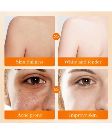 Skin Brightening Soap - Kojic Acid Soap for Dark Spots - Face Cleanser Soap - Dark Spot Remover Soap Bar - Clean Skin Oil Antioxidant Moisture - Skincare Beauty Product for All Type Skin - Buy Online on GoSupps.com