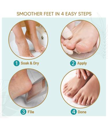 Love Lori Callus Remover Kit - Professional Foot Spa for Dead Skin Removal | Extra Strength Gel, Salon Foot File, Gloves - Home Pedicure Tools for Smooth Feet - Buy Online on GoSupps.com