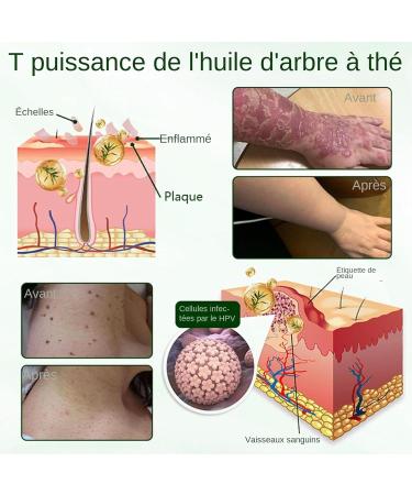  Zasdvn Facial Moisturizer - 50g Non-Greasy Soothing Moisturizing Gel Repairing Facial Care | For Men Women Adults Family Home Travel Beauty Skin Inner - Buy Online on GoSupps.com