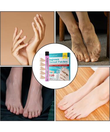 Ingrown Toenail Patch Ingrown Toenail Corrector | Toenail Repair to Relieve Nail Groove Nail Correction Patches Suitable for Men Women and Elderly Adern - Buy Online on GoSupps.com