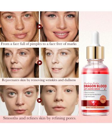 Dragon Blood Face Serum - Anti Wrinkle Face Serum for Women - Dark Spot Remover for Face - Anti Aging Face Care Serum - Dark Spot Correcting Glow Serum 30ml - Buy Online on GoSupps.com