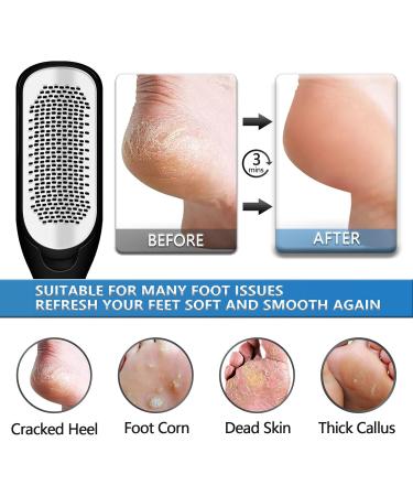 Foot File & Callus Remover - Dual-Sided Stainless Steel Foot Scrubber for Cracked Heels & Dead Skin - International Shipping - Buy Online on GoSupps.com
