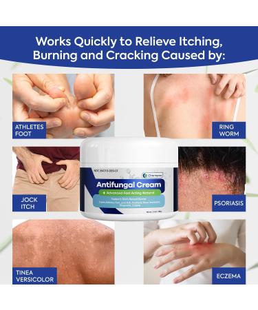 Extra Strength Antifungal Cream for Jock Itch & Itchy Skin Relief - Ringworm & Athlete's Foot Treatment - 3.4 oz - Buy Online on GoSupps.com