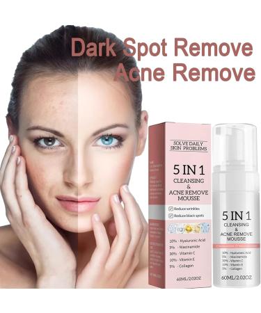 5 in 1 Foaming Cream Cleanser Blackhead Deep Pore Facial Cleansing Mousse Face Cleanser Oily Skin Face Wash with Niacinamide & Hyaluronic Acid Removes Excess Oil Unclogs Pores & Reduces Blackheads - Buy Online on GoSupps.com