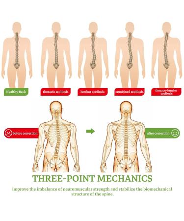 Adjustable Scoliosis Posture Corrector Brace for Kyphosis & Osteoporosis - International Shipping Available - Buy Online on GoSupps.com