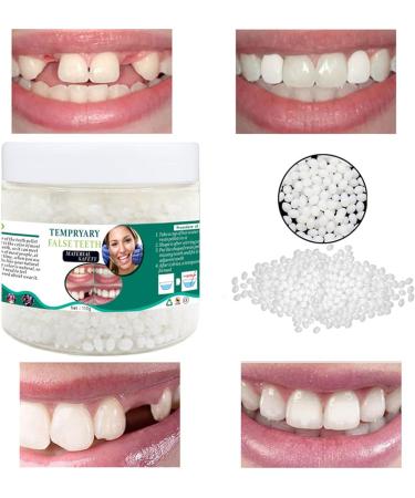 LDADGF Plastic Tooth Adhesive - Perfect Temporary Filling for Broken Teeth | Dental Adhesive for Oral Use (One Size White) - Buy Online on GoSupps.com
