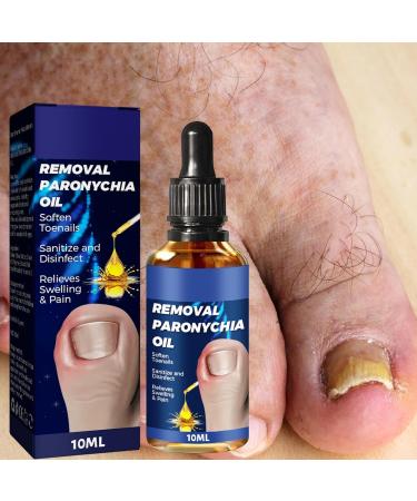 Nankoyal German toenail care removal paronychia oil 3 pack German toenail care oil for removing paronychia toenail correction drops nail renewal fluid for - Buy Online on GoSupps.com