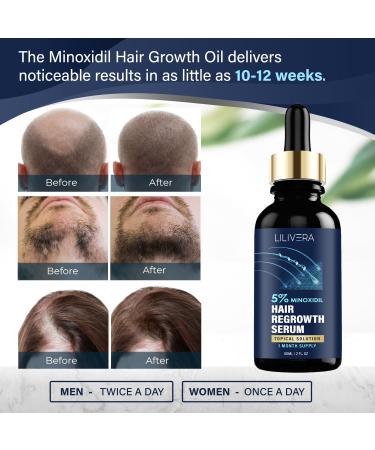 LILIVERA 5% Minoxidil for Men and Women Kit - 2 Fl Oz. - Buy Online on GoSupps.com