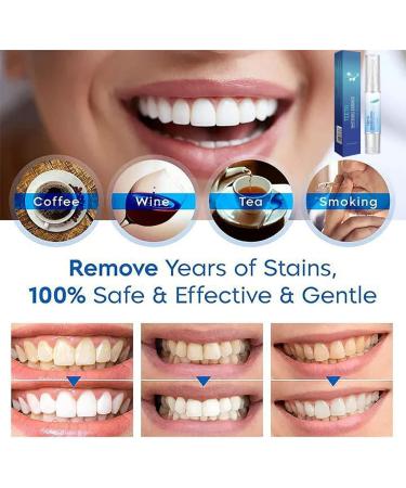 Jinxsen Teeth Whitening Essence Pen - Natural Stain Remover Gel Fast & Sensitivity-Free Travel-Friendly Tooth Whitening Solution - Buy Online on GoSupps.com