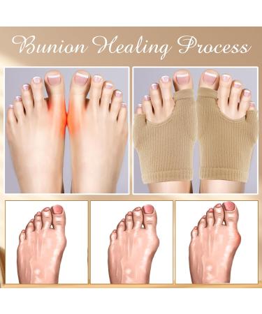 1 Pair Bunion Pads - Breathable Cushion Sleeve for Pain Relief | Comfortable Bunionette Corrector & Elastic Protector Day & Night Support for Men & Women - Buy Online on GoSupps.com