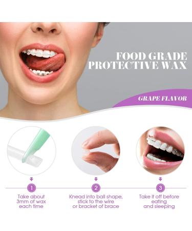 ROSENICE 10 Pieces Dental Wax for Orthodontic Braces Wearers - Purple | Premium Quality & Comfort | International Shipping - Buy Online on GoSupps.com