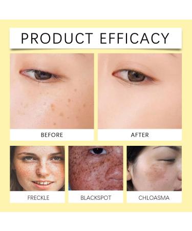 2024 New Astragalus Emollient Cream 50g Natural Astragalus Herbal Cream Organic Astragalus Root Cream Moisturizing Beauty Cream for Soft Skin (3) - Buy Online on GoSupps.com