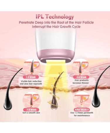Design Wish IPL Hair Removal Device - Permanent Laser Hair Remover for Women | 5 Energy Levels & 2 Modes for Armpits Legs & Body - Buy Online on GoSupps.com