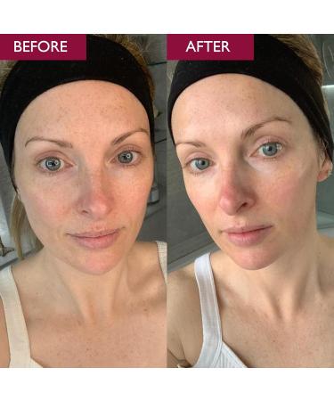 SKINICIAN Advanced Pro-Radiance Enzyme Peel - Peel Off Face Mask for Brighter Looking Skin - AHA Beauty Facial Mask - Anti-Ageing Fruit Enzyme Peel - Vegan & Cruelty Free (50ml) - Buy Online on GoSupps.com